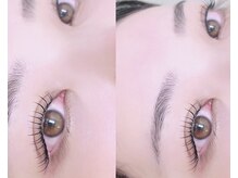 ララ(RARA)/アンドヘルシー100本