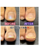 キラキラフット神領 ありが接骨院/巻き爪/フットケア