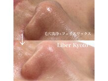 リベルキョウト 京都駅前店(Liber Kyoto)/タマゴ肌コース