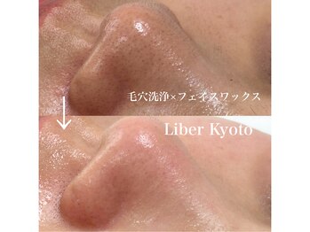 リベルキョウト 京都駅前店(Liber Kyoto)/タマゴ肌コース