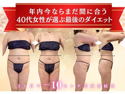 マノマノ エミュー(manomano emu)の写真