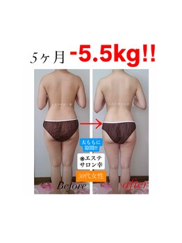 エステサロン 幸/30代 -5.5kg産後ダイエット