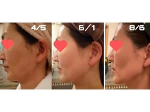 アンプリール(emplir)の雰囲気（【ドクターピュアラボ】認定サロンたるみ、シミ、しわ肌質改善に）