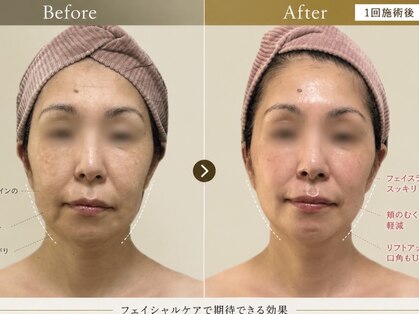 サロンハート(Salon Heart)の写真