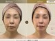 サロンハート(Salon Heart)の写真