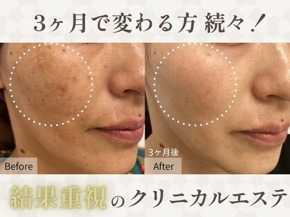 サクスィード 水戸本店(Succeed)の写真
