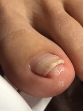 トゥーネイル(02nail)/