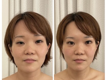 小顔デザイン 浜松店の写真