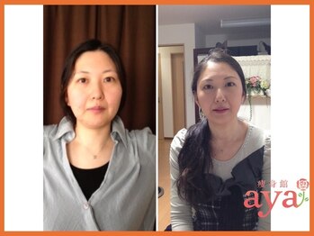 痩身館アヤ(aya)/耳つぼダイエット【富山/痩身】