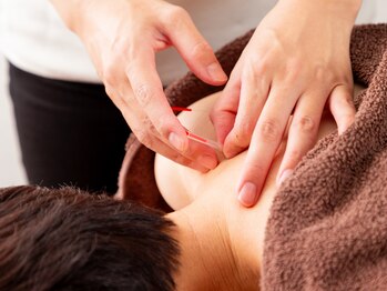 コンディショニングサロン クーラ(CURA)/肩こりに鍼灸