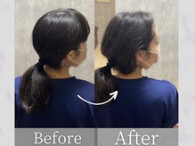 タケダ整体院/振り向けない首の改善事例