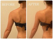 イリゼ(IRISER)/【30代肩こり解消】肩甲骨はがし