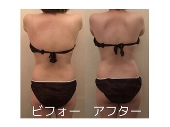ドクターエイジレス(DR.AGELESS)/福岡初の痩せる整体筋膜美容整体