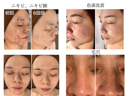 ベル みどりの店(belle)の写真