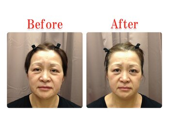 ビューティースリム タニダ/頭蓋骨&小顔&顎関節矯正