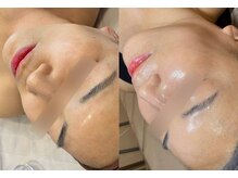 ユソン(YSN)の雰囲気(大人気肌育でノーファンデ肌へ!)