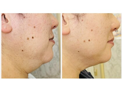 オッペンプラザ アルーリング(oppen plaza Alluring)の写真