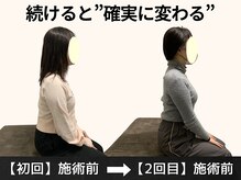 パルマ なかもず(Palma)/整体/頭痛/肩こり/ヘッドスパ