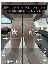 アムール 麻布十番(Amour)/エンダモロジーインフィニティ