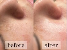 グランビューティ(Glanz Beauty)/30代女性