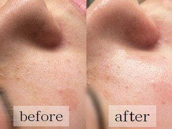 グランビューティ(Glanz Beauty)/30代女性