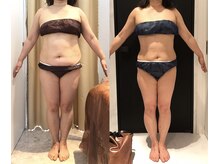 リボディ 表参道(An re Body)/before→after