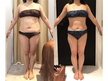 リボディ 表参道(An re Body)/before→after