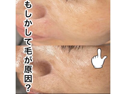 セレーノ(Sereno)の写真