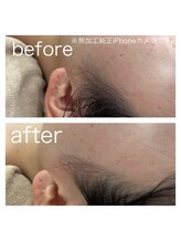 ラクシー 北千住(luxssy)/もみあげ周りシェービング