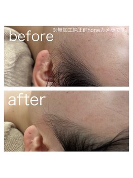 ラクシー 北千住(luxssy)/もみあげ周りシェービング