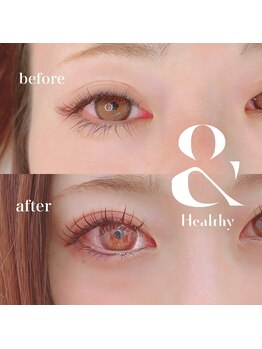 アネラ(ANELA)/LEDアンドヘルシー120【小山市】