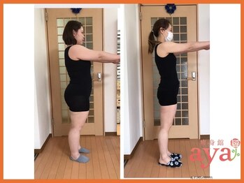 痩身館アヤ(aya)/耳つぼダイエット【富山/痩身】