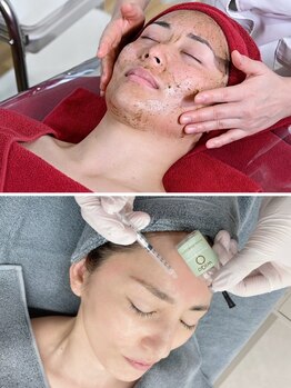 サロンドアモール(Salon de a mole)の写真/【何をしても変わらなかった方必見！】ハ-バルシ-/wiqo水光ピールで理想の艶肌に♪肌質,悩みに沿ってご案内
