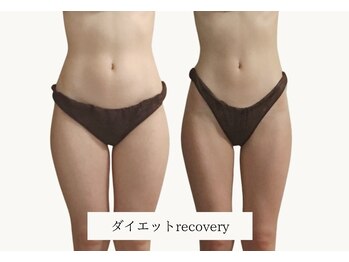 リカバリー(&recovery)/ダイエットrecovery/骨洗浄