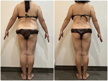 美容整体 ウェリナ 蟹江院/小顔矯正/骨盤矯正/美脚サロン 