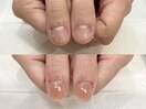 深爪矯正 自爪育成 ネイルケア