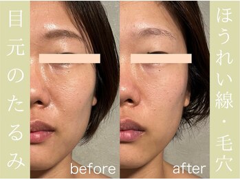 健志接骨院/πテラピー造顔メソッド