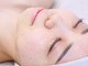 ナーナモエ(na-namoe)の写真/働く女性に大人気！韓国発セルマンで叶える究極の美白ケア。ダウンタイムなし、施術直後からメイクOK！