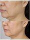 ルアナ(Luana)の写真/毎日頑張る貴女への大切な時間!98%が眠る極上の手技でドライヘッド/フェイシャルケアでゆっくりと♪