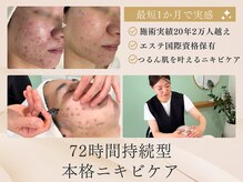 シェノン 赤坂大濠店