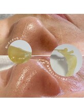 レイビューティサロン(Lei beauty salon)/水光肌Waxで毛穴デトックス！