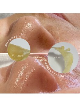 レイビューティサロン(Lei beauty salon)/水光肌Waxで毛穴デトックス！