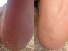 メグムサロン(Megumu Salon)/足つぼ/角質/マッサージ