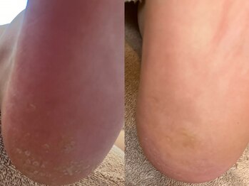 メグムサロン(Megumu Salon)/足つぼ/角質/マッサージ