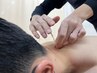 【しつこい首痛・腰痛には！】マッサージ20分＋鍼灸　￥9,900 計60分