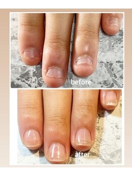 ミリアネイル 成城(Miliea nail)/