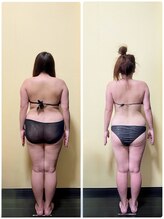 ビジュクイーン(BIJOU QUEEN)/3ヶ月でー13kg達成！｜痩身梅田