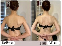 ソウ バイ ソウ(So by 蒼)/機器より、技。力より、技。