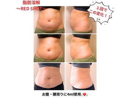 サロン ミノリ(salon MINORI)の写真