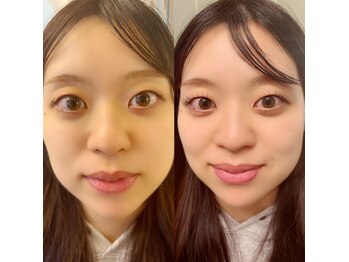 グロウビューティー(grow beauty)/